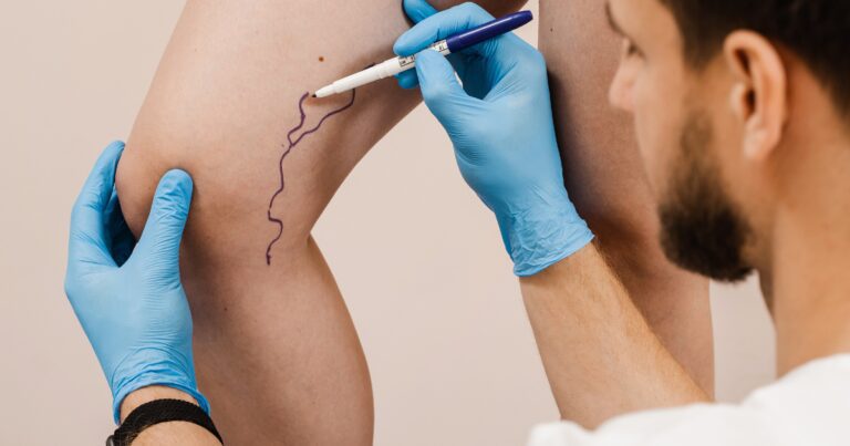 Vein doctor in Peoria Arizona prepping patient for VenaSeal treatment