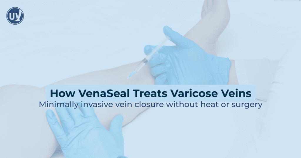 Graphic explaining how Venaseal treats varicose veins