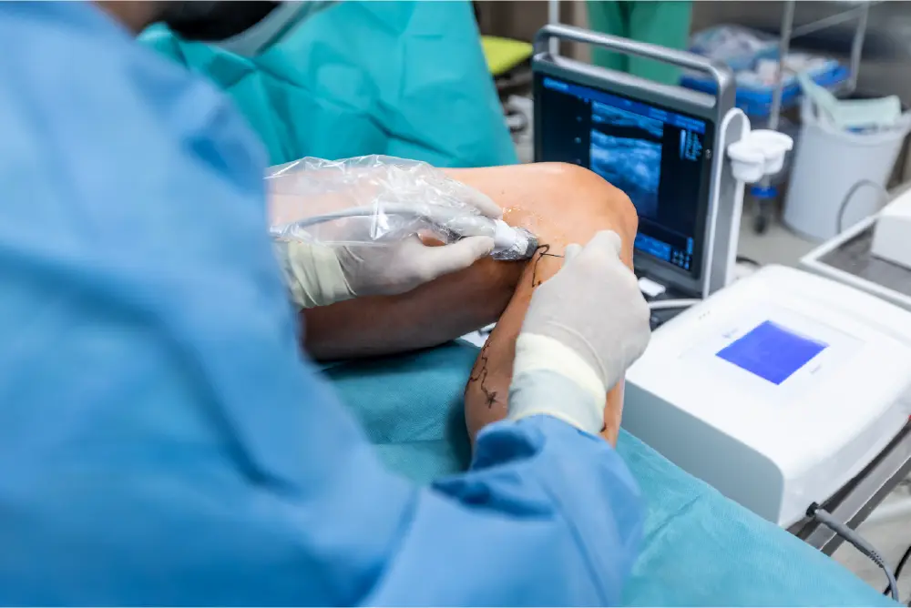A vein doctor performing ultrasound-guided sclerotherapy on a person's leg