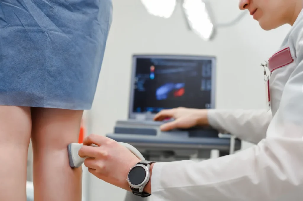 A vein doctor performing ultrasound guided sclerotherapy in Newnan, GA