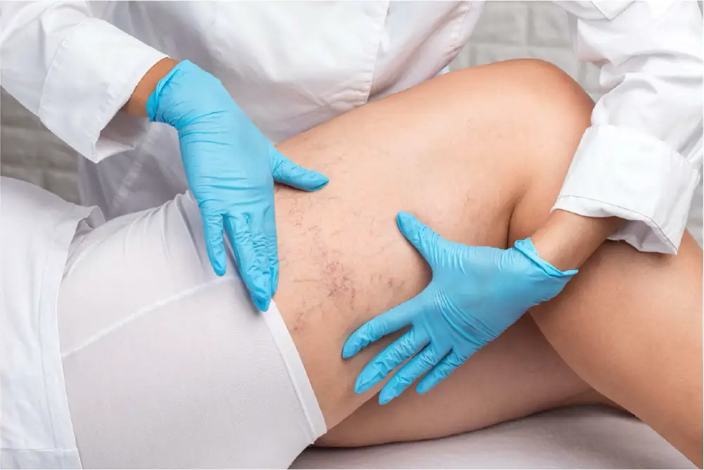 A vein specialist performing a vein screening in Atlanta