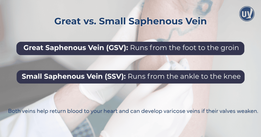 graphic explaining great vs small Saphenous vein