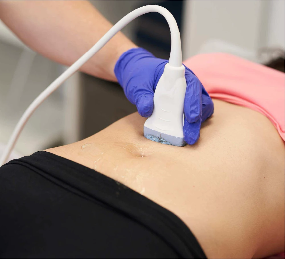 https://unitedveincenters.com/wp-content/uploads/2026/09/pelvic-vein-embolization-4.webp